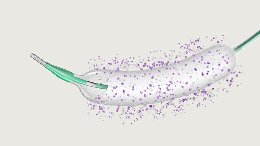 SeQuent® SCB – Sirolimusbelagd ballong