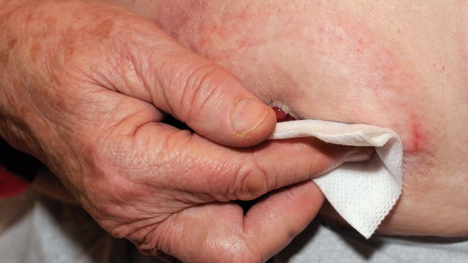 handen rengör stomin