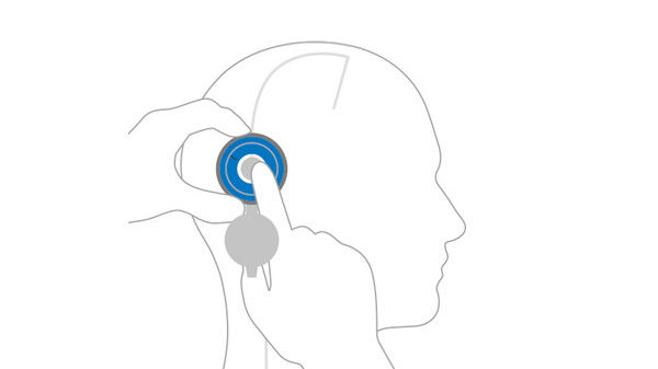 Illustration av hur man justerar M.blue plus®