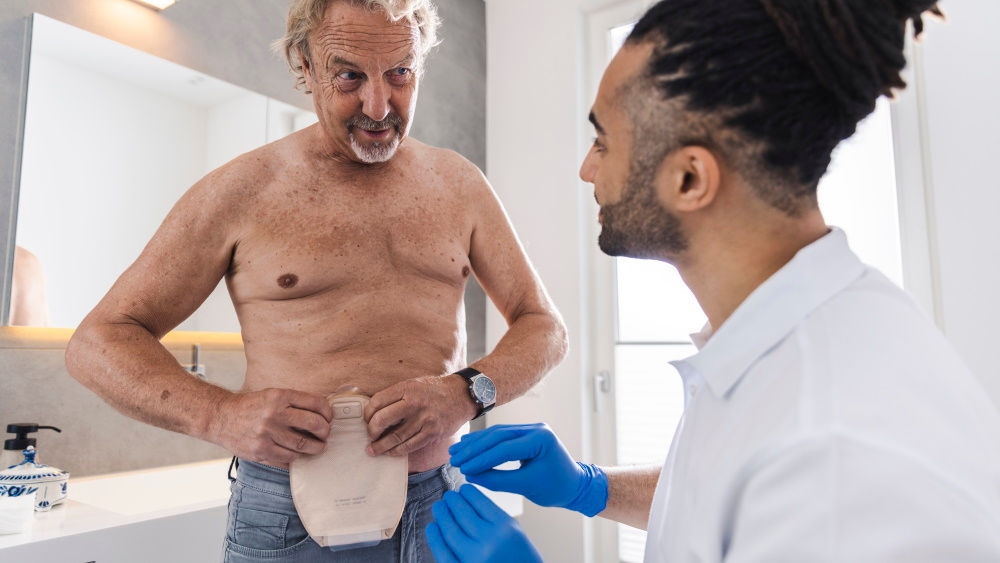 Man med stomipåse på naken överkropp med manlig sjuksköterska med handskar som visar hur påsen ska appliceras