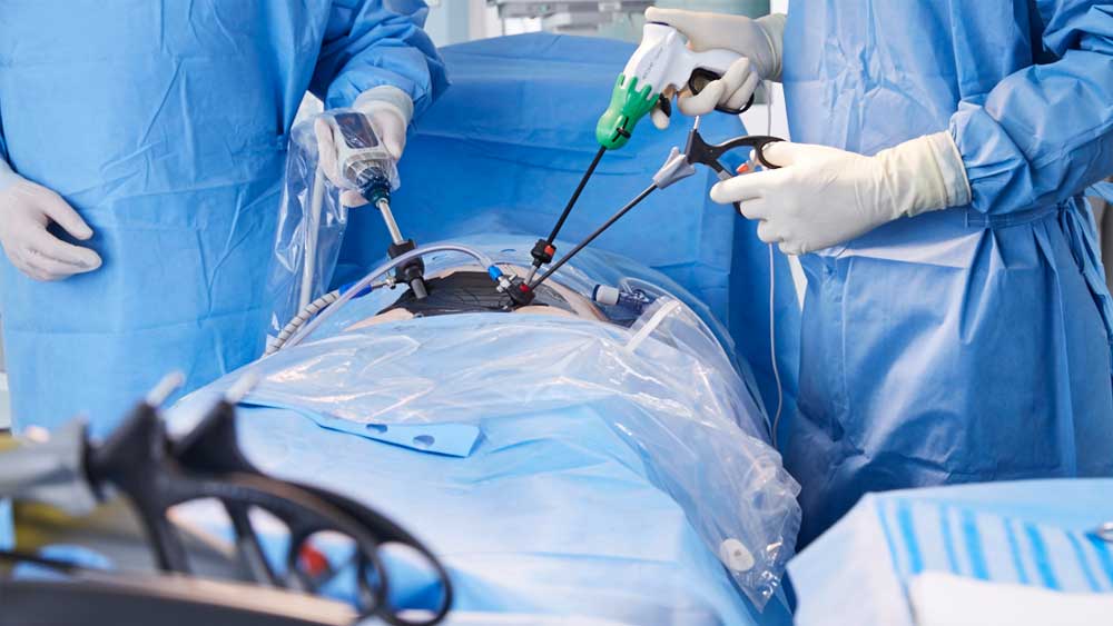 En detalj av en minimalinvasiv operationssituation med AESCULAP Caiman