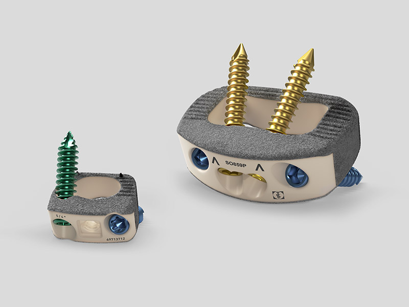 Plasmapore XP-belagda interbody-fusionsimplantat.